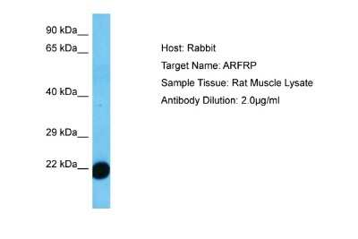 Western Blot: ARFRP1 Antibody [NBP2-87025]