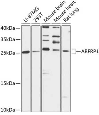 Western Blot: ARFRP1 AntibodyAzide and BSA Free [NBP2-92150]