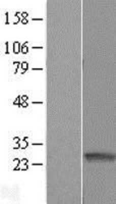 Western Blot: ARFRP1 Overexpression Lysate [NBL1-07661]