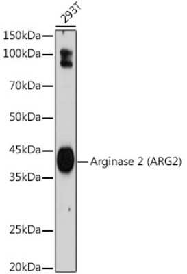 Western Blot: ARG2 Antibody (1Y5U3) [NBP3-15697]