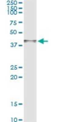 Immunoprecipitation: ARG2 Antibody (3D10) [H00000384-M05]