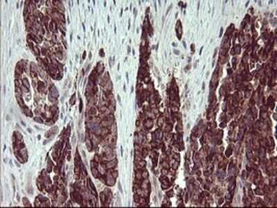 Immunohistochemistry: ARG2 Antibody (OTI3G5) [NBP2-46539]