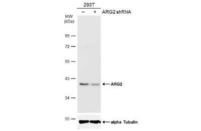 Western Blot: ARG2 Antibody (GT11111) [NBP3-13616]