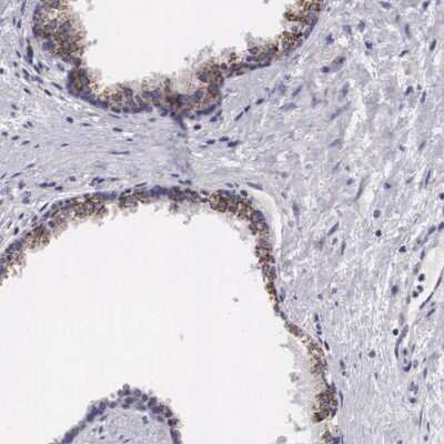Immunohistochemistry-Paraffin: ARG2 Antibody [NBP1-86189]