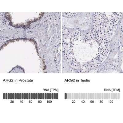 Immunohistochemistry-Paraffin: ARG2 Antibody [NBP1-86189]