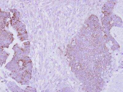 Immunohistochemistry-Paraffin: ARG2 Antibody [NBP2-15446]