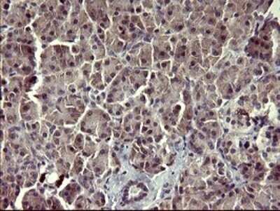 Immunohistochemistry: ARG2 Antibody (OTI3G5) - Azide and BSA Free [NBP2-70205]