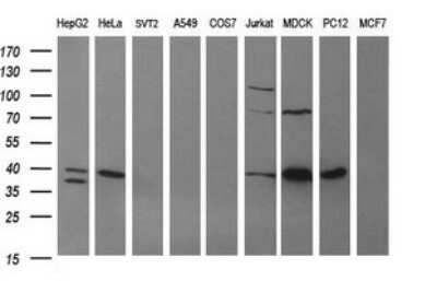 Western Blot: ARG2 Antibody (OTI3G5)Azide and BSA Free [NBP2-70205]