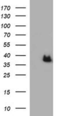 Western Blot: ARG2 Antibody (OTI3G5)Azide and BSA Free [NBP2-70205]