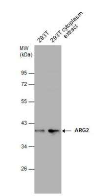 Western Blot: ARG2 Antibody [NBP2-15445]