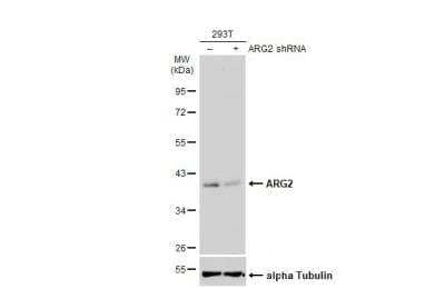 Western Blot: ARG2 Antibody [NBP2-15445]