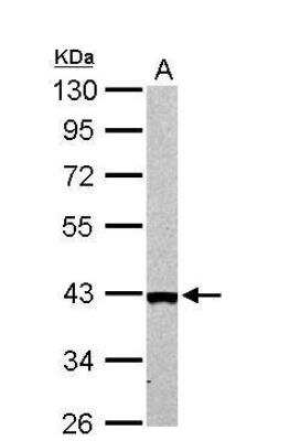 Western Blot: ARG2 Antibody [NBP2-15446]