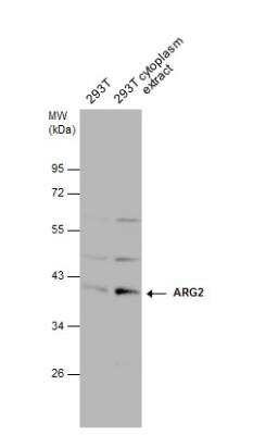 Western Blot: ARG2 Antibody [NBP2-15446]