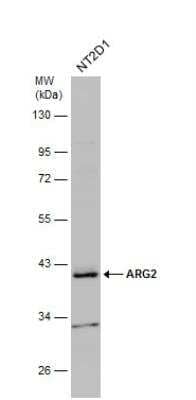 Western Blot: ARG2 Antibody [NBP2-15446]