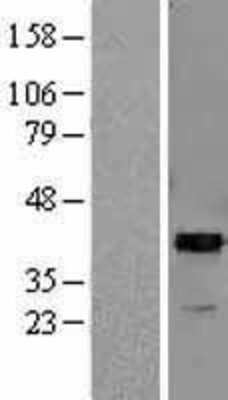 Western Blot: ARG2 Overexpression Lysate [NBL1-07663]