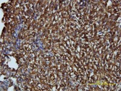 Immunohistochemistry-Paraffin: ARH Antibody (4G4-D5) [H00026119-M01]
