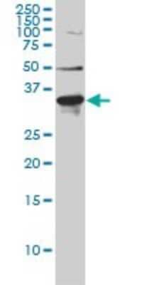 Western Blot: ARH Antibody (4G4-D5) [H00026119-M01]