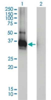 Western Blot: ARH Antibody (4G4-D5) [H00026119-M01]