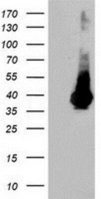 Western Blot: ARH Antibody (OTI7E11) [NBP2-01435]