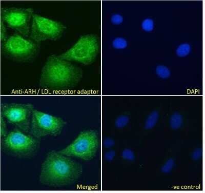 Immunocytochemistry/ Immunofluorescence: ARH Antibody [NB100-1276]