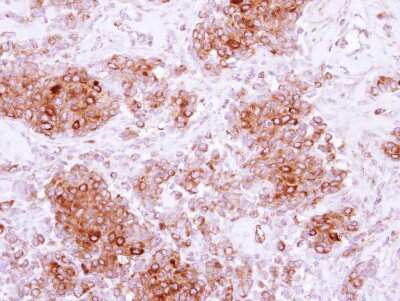 Immunohistochemistry-Paraffin: ARH Antibody [NBP2-15449]