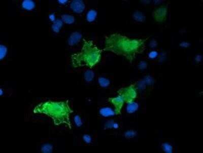 Immunocytochemistry/ Immunofluorescence: ARH Antibody (OTI7E11) - Azide and BSA Free [NBP2-71790]