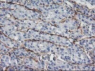 Immunohistochemistry: ARH Antibody (OTI7E11) - Azide and BSA Free [NBP2-71790]