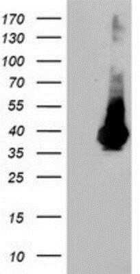 Western Blot: ARH Antibody (OTI7E11)Azide and BSA Free [NBP2-71790]