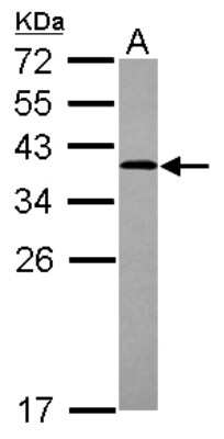 Western Blot: ARH Antibody [NBP2-15449]