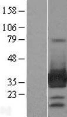 Western Blot: ARH Overexpression Lysate [NBL1-12478]