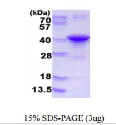 SDS-PAGE: Recombinant Human ARH His Protein [NBP1-78895]