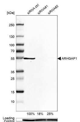 Western Blot: ARHGAP1 Antibody [NBP1-85724]