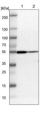 Western Blot: ARHGAP1 Antibody [NBP1-85725]