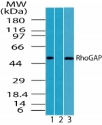 Western Blot: ARHGAP1 Antibody [NBP2-24707]