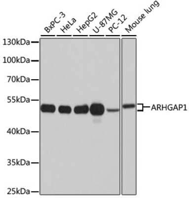 Western Blot: ARHGAP1 AntibodyAzide and BSA Free [NBP2-92692]