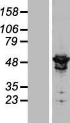 Western Blot: ARHGAP1 Overexpression Lysate [NBL1-07665]