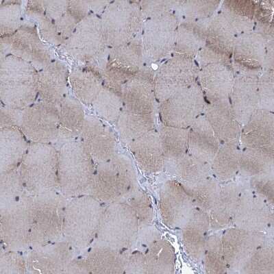 Immunohistochemistry-Paraffin: ARHGAP11A Antibody [NBP1-93657]