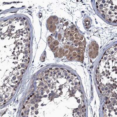 Immunohistochemistry-Paraffin: ARHGAP11A Antibody [NBP1-93657]