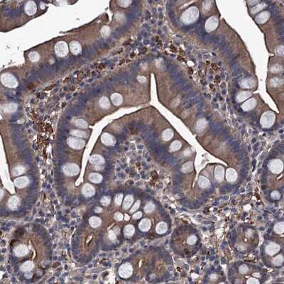 Immunohistochemistry-Paraffin: ARHGAP11A Antibody [NBP1-93657]