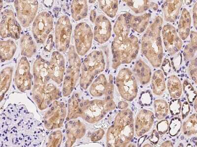 Immunohistochemistry-Paraffin: ARHGAP11A Antibody [NBP2-99558]