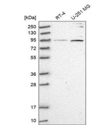 Western Blot: ARHGAP11A Antibody [NBP1-93657]