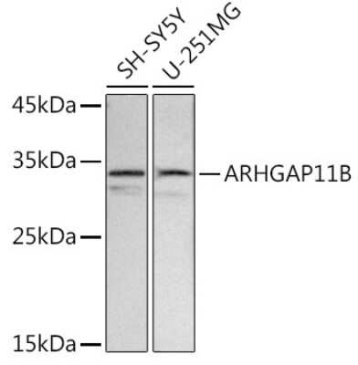 Western Blot: ARHGAP11B AntibodyAzide and BSA Free [NBP3-05582]