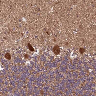 Immunohistochemistry-Paraffin: ARHGAP12 Antibody [NBP1-91678]
