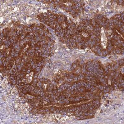Immunohistochemistry-Paraffin: ARHGAP12 Antibody [NBP1-91678]