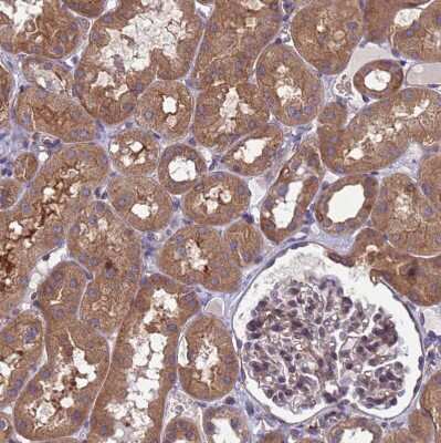 Immunohistochemistry-Paraffin: ARHGAP12 Antibody [NBP1-91678]