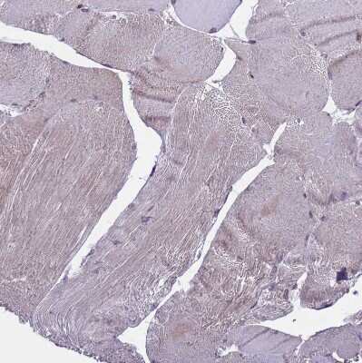 Immunohistochemistry-Paraffin: ARHGAP12 Antibody [NBP1-91678]