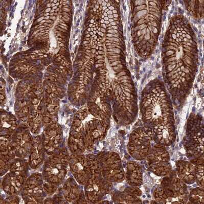 Immunohistochemistry-Paraffin: ARHGAP12 Antibody [NBP1-91678]