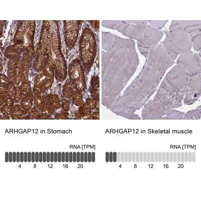 Immunohistochemistry-Paraffin: ARHGAP12 Antibody [NBP1-91678]