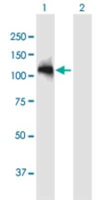 Western Blot: ARHGAP12 Antibody [H00094134-B01P]