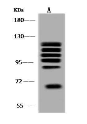 Western Blot: ARHGAP12 Antibody [NBP3-06233]